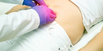 ഹെര്‍ണിയയ്ക്ക് ശസ്ത്രക്രീയ ഉത്തമ പരിഹാരമോ?