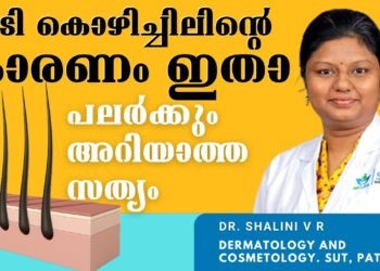 ദാ ഇതാണ് നിങ്ങളുടെ മുടികൊഴിയാന്‍ കാരണം