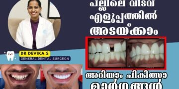 ധൈര്യമായി ചിരിക്കാം, പല്ലിലെ വിടവ് നികത്താന്‍ എളുപ്പ മാര്‍ഗം | Dr. Devika S | Dentalcare #dental