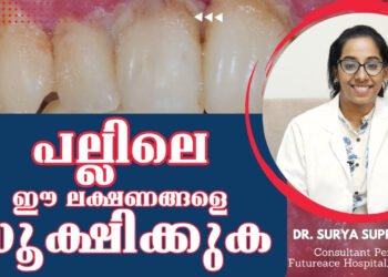 മോണ രോഗങ്ങള്‍ | Periodontal (gum) disease
