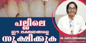 മോണ രോഗങ്ങള്‍ | Periodontal (gum) disease