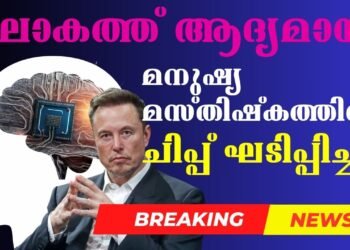 Wireless Brain Chip In Human For 1st Time