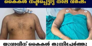 Hand Replacement Surgery