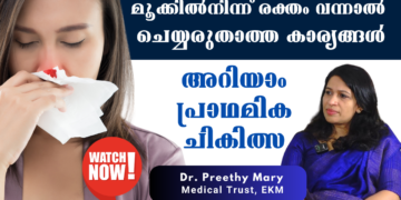 EPISTAXIS Primary Treatment