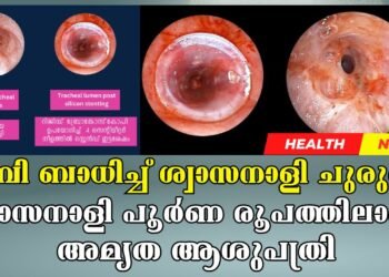 Amritha Hospital Kochi