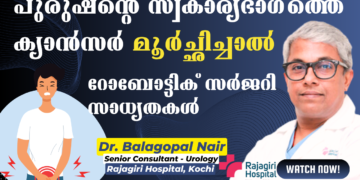 Prostate Cancer and Robotic Surgery