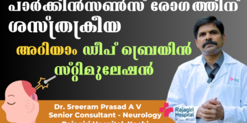 Deep Brain Stimulation