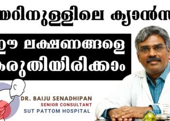 Stomach Cancer Symptoms