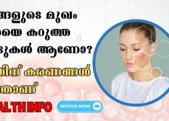 Face Full Of Black Spots