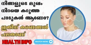 Face Full Of Black Spots