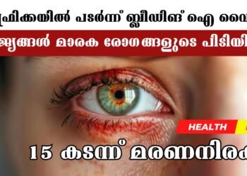 Today’s Health News 04-12-2024