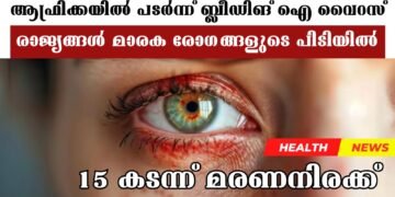 Today’s Health News 04-12-2024