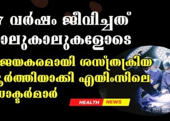 Successful Surgery Completed On 17-Year-Old With 4 Legs