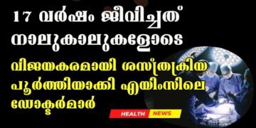 Successful Surgery Completed On 17-Year-Old With 4 Legs