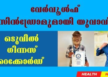 Today’s Health News 19-03-2025