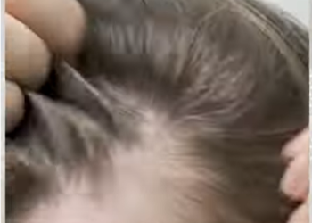 നര അകറ്റാൻ നാച്യുറൽ  ഹെയർ ഡൈ