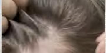 നര അകറ്റാൻ നാച്യുറൽ  ഹെയർ ഡൈ