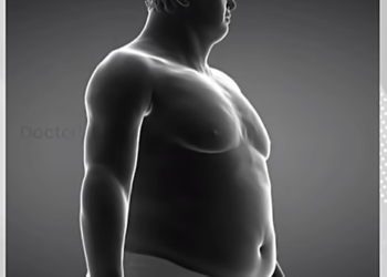 കാൻസർ രോ​ഗികളിൽ ശരീരഭാരം കുറയുന്നത് എന്തുകൊണ്ട്