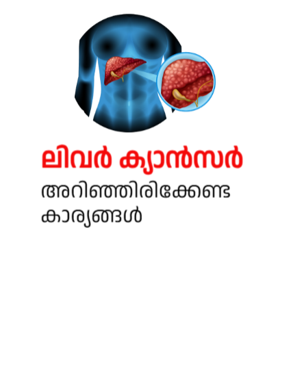 ലിവർ ക്യാൻസർ അറിഞ്ഞിരിക്കേണ്ട കാര്യങ്ങൾ