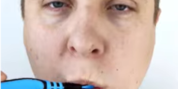 പല്ലുതേച്ചു കഴിയുമ്പോൾ മോണയിൽ രക്തം വരാറുണ്ടോ