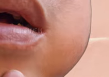 ജില്ലയിൽ മുണ്ടിനീര് വ്യാപിക്കുന്നതായി റിപ്പോർട്ട്