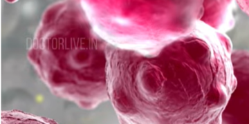 അർബുദം രോഗികൾക്ക് ഹൃദ്രോഗ സാധ്യത കൂടുതലോ