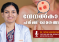 വേനല്‍കാല ചര്‍മ്മ രോഗങ്ങളെ പ്രതിരോധിക്കാം