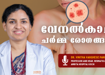 വേനല്‍കാല ചര്‍മ്മ രോഗങ്ങളെ പ്രതിരോധിക്കാം